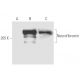Neurofibromin Antibody (McNFn27a) - Western Blotting - Image 438