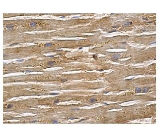 Neurofibromin Antibody (McNFn27b) - Immunohistochemistry - Image 156543 