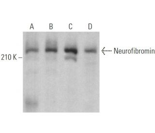 Neurofibromin Antibody (E-8) - Western Blotting - Image 375106