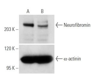 Neurofibromin siRNA (h): sc-36036. Western blot analysis of Neurofibromin expression in non-transfected control (A) and Ne 