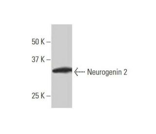 Neurogenin 2 Antibody (2A8) - Western Blotting - Image 352211SAM Transcription Activation: SAM system utilizing dCas9-VP64, MS2-P65-HSF1, and sgRNA for precise gene transcription activation.