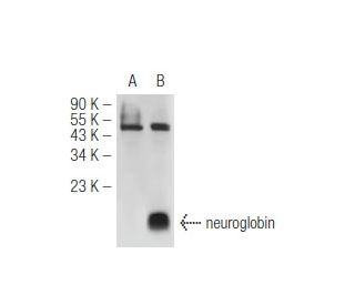 western blotting image from recommended neuroglobin (G-11) monoclonal antibody replacement. Image 45473
