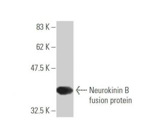 Neurokinin B Antibody (1B2) - Western Blotting - Image 348860