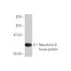 Neurokinin B Antibody (1B2) - Western Blotting - Image 348860