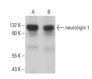 neuroligin 1 Antibody (A-4) - Western Blotting - Image 378140SAM Transcription Activation: SAM system utilizing dCas9-VP64, MS2-P65-HSF1, and sgRNA for precise gene transcription activation.