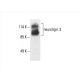 neuroligin 3 Antibody (G-2) - Western Blotting - Image 393558