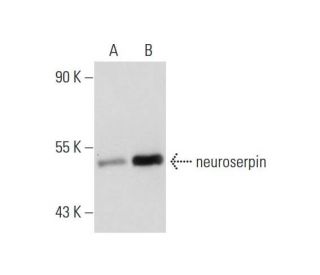neuroserpin (C-9): sc-48360. Western blot analysis of neuroserpin expression in non-transfected: sc-110760 (A) and human n