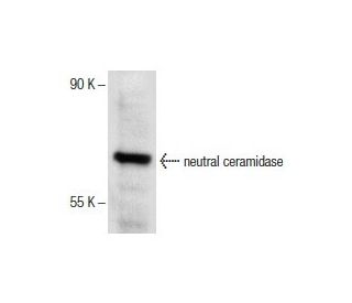 neutral ceramidase Antibody (B-9) - Western Blotting - Image 154052 