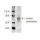 neutral ceramidase Antibody (B-9) - Western Blotting - Image 396083