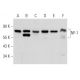 This polyclonal antibody has been discontinued. See our recommended <a href="nf-1-antibody-d-2">NF-1 (D-2)</a> monoclonal antibody (sample data shown). western blotting image from recommended NF-1 (D-2) monoclonal antibody replacement. Image 356927
