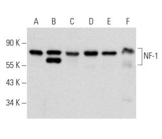 western blotting image from recommended NF-1 (D-2) monoclonal antibody replacement. Image 356927