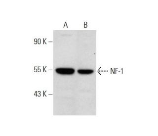 NF-1 Antibody (F-2) - Western Blotting - Image 308332 
