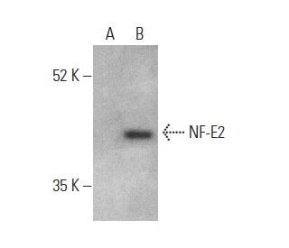 NF-E2 Antibody (G-2) - Western Blotting - Image 400015 