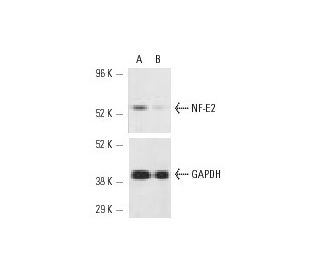 NF-E2 siRNA (h): sc-36046. Western blot analysis of NF-E2 expression in non-transfected control (A) and NF-E2 siRNA transf 