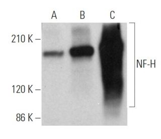 western blotting image from recommended NF-H (RNF402) monoclonal antibody replacement. Image 374913