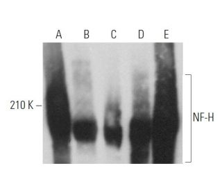 Anti Nf H Antibody Rnf402 Scbt Santa Cruz Biotechnology