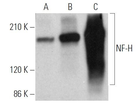 Anti Nf H Antibody Rnf402 Scbt Santa Cruz Biotechnology