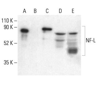NF-L Antibody (8A1)  SCBT - Santa Cruz Biotechnology
