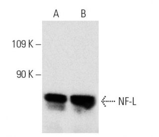 western blotting image from recommended NF-L (8A1) monoclonal antibody replacement. Image 4409