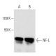 western blotting image from recommended NF-L (8A1) monoclonal antibody replacement. Image 4409
