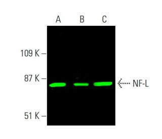 NF-L Antibody (8A1) - Western Blotting - Image 386222