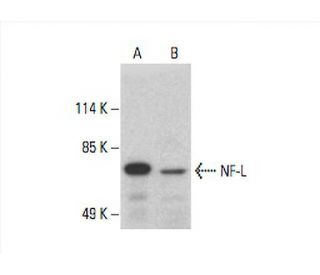 NF-L Antibody (8A1) - Western Blotting - Image 392966