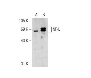 NF-L Antibody (8A1) - Western Blotting - Image 126387