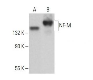 NF-M Antibody (1A2) - Western Blotting - Image 381764 