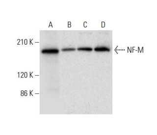 NF-M Antibody (E-9) - Western Blotting - Image 305742