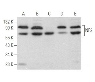 western blotting image from recommended Neurofibromin 2/NF2/Merlin (B-12) monoclonal antibody replacement. Image 355825