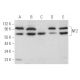 western blotting image from recommended Neurofibromin 2/NF2/Merlin (B-12) monoclonal antibody replacement. Image 355825