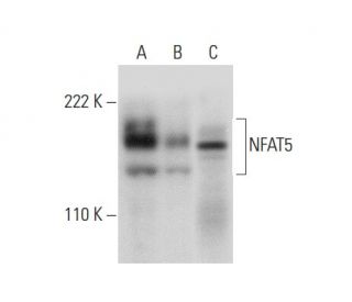 western blotting image from recommended NFAT5 (F-9) monoclonal antibody replacement. Image 301475