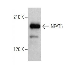 NFAT5 Antibody (F-9) - Western Blotting - Image 363432