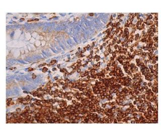 immunohistochemistry image from recommended NFATc1 (7A6) monoclonal antibody replacement. Image 352928
