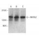 Este anticuerpo policlonal ha dejado de fabricarse. Consulta nuestro anticuerpo monoclonal recomendado <a href="nfatc2-antibody-4g6-g5">NFATc2 (4G6-G5)</a> (se muestran datos de muestra). western blotting image from recommended NFATc2 (4G6-G5) monoclonal antibody replacement. Image 379211