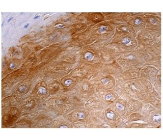 immunohistochemistry image from recommended NFATc4 (B-2) monoclonal antibody replacement. Image 160213