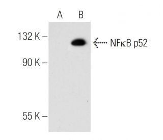 NFκB p52/p100/NFKB2 Antibody (C-5) - Western Blotting - Image 53112Each CRISPR/Cas9 Knockout (KO) Plasmid product consists of a pool of 3 plasmids designed to ensure identification and cleavage of a specific gene for maximum knockout efficiency. Each plasmid encodes a unique 20 nt sequence derived from the GeCKO (v2) library.