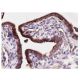 Este anticuerpo policlonal ha dejado de fabricarse. Consulta nuestro anticuerpo monoclonal recomendado <a href="nfkappab-p50-antibody-e-10">NFκB p50 (E-10)</a> (se muestran datos de muestra). immunohistochemistry image from recommended NFκB p50 (E-10) monoclonal antibody replacement. Image 156586