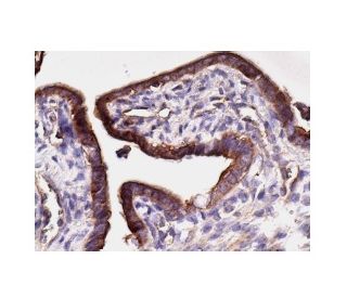 immunohistochemistry image from recommended NF&kappa;B p50 (E-10) monoclonal antibody replacement. Image 156586