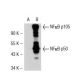 NF kappa B p50 (4D1): sc-53744. Western blot analysis of NF kappa B p50...