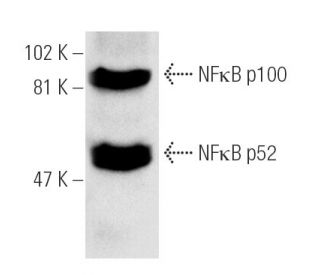 western blotting image from recommended NFκB p52/p100/NFKB2 (C-5) monoclonal antibody replacement. Image 1030