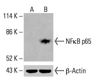 nfkappab-p65-antibody-a-12-
