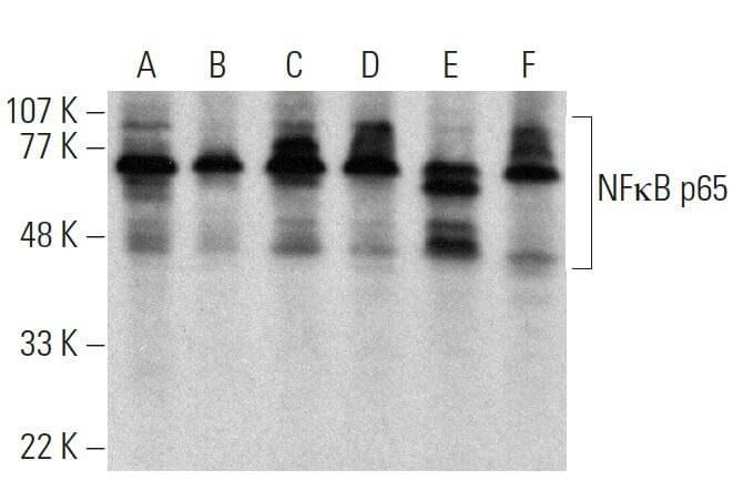 NFκB p65 Antibody (A) | SCBT - Santa Cruz Biotechnology