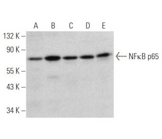 RELA/NFκB P65 Antibody (E-5) | SCBT - Santa Cruz Biotechnology