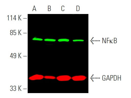 RELA/NFκB p65 Antibody (F-6) | SCBT - Santa Cruz Biotechnology