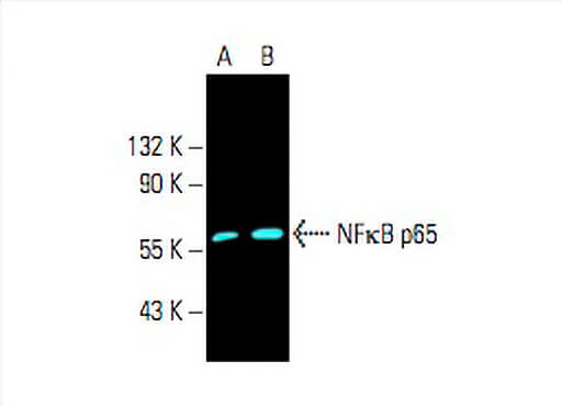 Western blots show p65 antibodies that passed the test of specificity