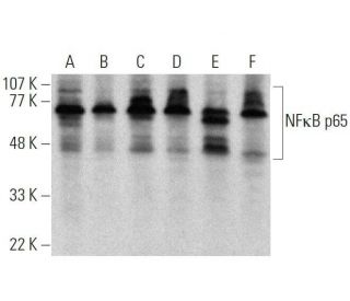 western blotting image from recommended RELA/NF&kappa;B p65 (F-6) monoclonal antibody replacement. Image 359554