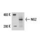 이 다클론 항체는 생산이 중단되었습니다. 권장 <a href="ng2-antibody-lhm-2">NG2 (LHM 2)</a> 단클론 항체(샘플 데이터 표시)를 참조하세요. western blotting image from recommended NG2 (LHM 2) monoclonal antibody replacement. Image 15830