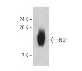 NGF Antibody (B-4) - Western Blotting - Image 399406The Double Nickase Plasmid features a U6 promoter for sgRNA expression, a 20 nt targeting sequence, and a gRNA scaffold to guide Cas9n. It includes a CBh promoter for Cas9n (D10A) and puromycin resistance, GFP for transfection verification, and nuclear localization signals (NLS). The 2A peptide allows co-expression of Cas9n and Puro from a single promoter, enabling precise genome editing with reduced off-target effects. 