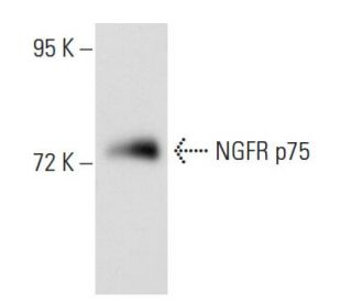 NGFR p75 Antibody (0.N.469) - Western Blotting - Image 53548 